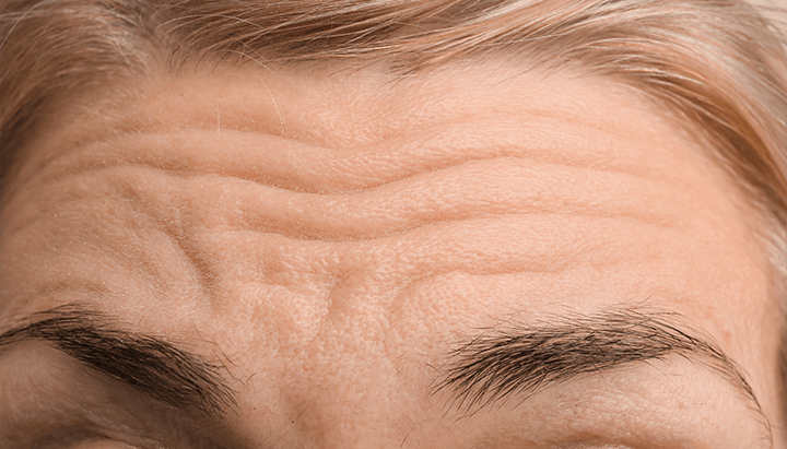 Anti-Aging