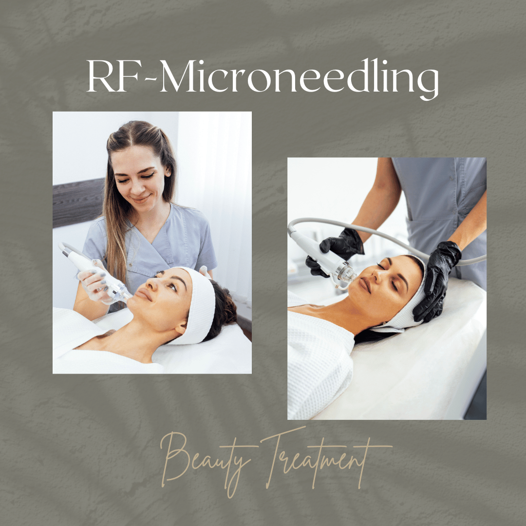 rf microneedling